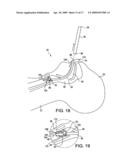 System for providing an open airway and methods of use thereof diagram and image