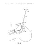 System for providing an open airway and methods of use thereof diagram and image