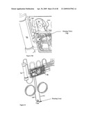 PERSONAL HEMODIALYSIS SYSTEM diagram and image