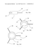 Fluid Filter Apparatus and Methods diagram and image