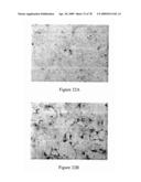 METHODS FOR DETECTING INFLAMMATORY BOWEL DISEASE diagram and image