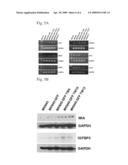 Genes relating to gastric cancer metastasis diagram and image