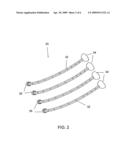 STRUCTURE FOR MOUNTING CHANDELIER ARMS diagram and image