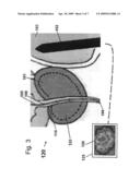 Prostate imaging diagram and image