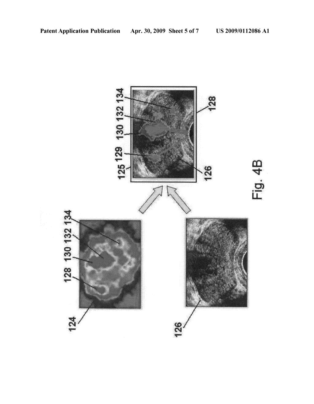 Prostate imaging - diagram, schematic, and image 06