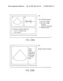 Portable ultrasound imaging data diagram and image