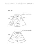 ULTRASOUND IMAGING APPARATUS AND ULTRASOUND IMAGING METHOD diagram and image