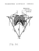 Portable Electrocardiogram diagram and image