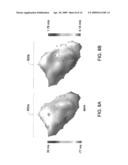 RECONSTRUCTION OF GEOMETRY OF A BODY COMPONENT AND ANALYSIS OF SPATIAL DISTRIBUTION OF ELECTROPHYSIOLOGICAL VALUES diagram and image