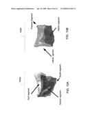 RECONSTRUCTION OF GEOMETRY OF A BODY COMPONENT AND ANALYSIS OF SPATIAL DISTRIBUTION OF ELECTROPHYSIOLOGICAL VALUES diagram and image