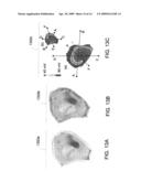 RECONSTRUCTION OF GEOMETRY OF A BODY COMPONENT AND ANALYSIS OF SPATIAL DISTRIBUTION OF ELECTROPHYSIOLOGICAL VALUES diagram and image