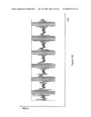 System And Method For Discrimination Of Central And Obstructive Disordered Breathing Events diagram and image