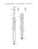 NITINOL GUIDEWIRE diagram and image