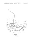 DEVICES AND METHOD FOR APPLYING VIBRATIONS TO JOINTS diagram and image