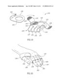 DEVICES AND METHOD FOR APPLYING VIBRATIONS TO JOINTS diagram and image