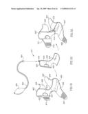 DEVICES AND METHOD FOR APPLYING VIBRATIONS TO JOINTS diagram and image