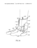 DEVICES AND METHOD FOR APPLYING VIBRATIONS TO JOINTS diagram and image