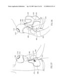 DEVICES AND METHOD FOR APPLYING VIBRATIONS TO JOINTS diagram and image