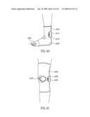 DEVICES AND METHOD FOR APPLYING VIBRATIONS TO JOINTS diagram and image