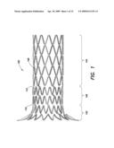 Delivery System With Profiled Sheath Having Balloon-Oriented Position diagram and image