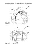 Method for Inserting a Medical Device Flexible Conduit into a User s Target Site diagram and image