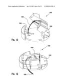 Integrated Conduit Insertion Medical Device diagram and image