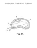 SYSTEM AND METHOD FOR MEASURING THE SHAPE OF INTERNAL BODY CAVITIES diagram and image