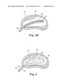 SYSTEM AND METHOD FOR MEASURING THE SHAPE OF INTERNAL BODY CAVITIES diagram and image