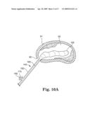 SYSTEM AND METHOD FOR MEASURING THE SHAPE OF INTERNAL BODY CAVITIES diagram and image