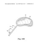 SYSTEM AND METHOD FOR MEASURING THE SHAPE OF INTERNAL BODY CAVITIES diagram and image