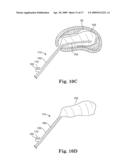 SYSTEM AND METHOD FOR MEASURING THE SHAPE OF INTERNAL BODY CAVITIES diagram and image