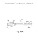 SYSTEM AND METHOD FOR MEASURING THE SHAPE OF INTERNAL BODY CAVITIES diagram and image