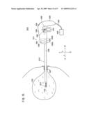 MANIPULATOR FOR MEDICAL USE diagram and image