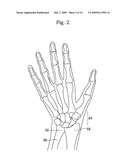 Shock absorber for sports diagram and image