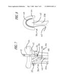 Crutch support system diagram and image