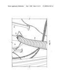 Methods and apparatus to make rubber crumb particles diagram and image