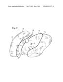 Airbag and Airbag Apparatus diagram and image