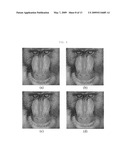 Method For Reversible Image Watermarking Based On Integer-to-Integer Wavelet Transform diagram and image