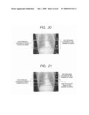 MEDICAL IMAGE MANAGEMENT DEVICE AND MEDICAL IMAGE SYSTEM diagram and image