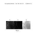 Method and system for human vision model guided medical image quality assessment diagram and image