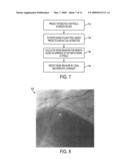 Method and system for human vision model guided medical image quality assessment diagram and image