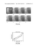 Method and system for human vision model guided medical image quality assessment diagram and image