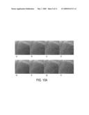 Method and system for human vision model guided medical image quality assessment diagram and image