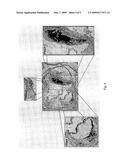 USE OF A FUSION PROTEIN TARGETING THE ED-B FIBRONECTIN DOMAIN FOR TREATMENT OF ATHEROSCLEROSIS diagram and image