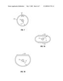 Apparatus for Avoiding Tangling of a Surf Leash diagram and image