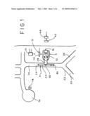 Implantable counterpulsation cardiac assist device diagram and image