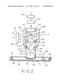 Implantable counterpulsation cardiac assist device diagram and image