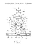 Implantable counterpulsation cardiac assist device diagram and image