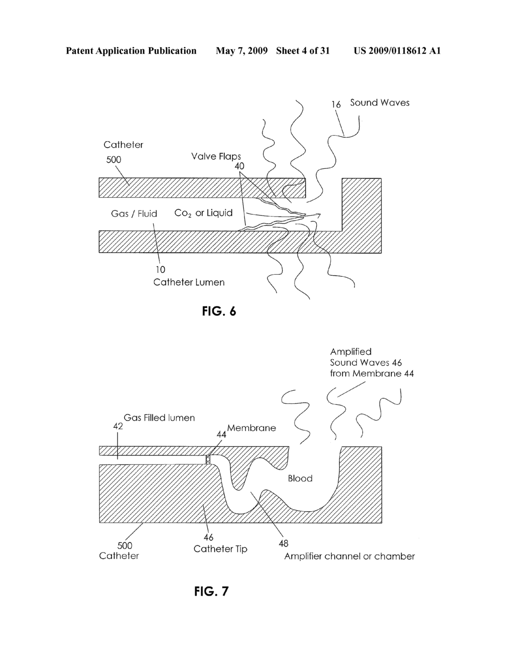 Apparatus and Method for Vascular Access - diagram, schematic, and image 05