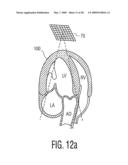 Three Dimensional Ultrasonic Scanning With a Steerable Volumetric Region diagram and image